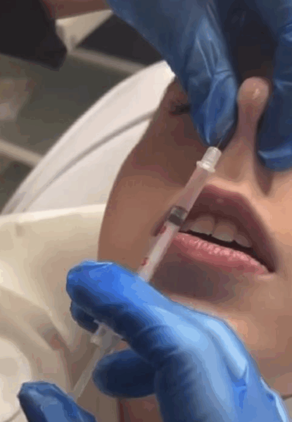 Advanced Botox